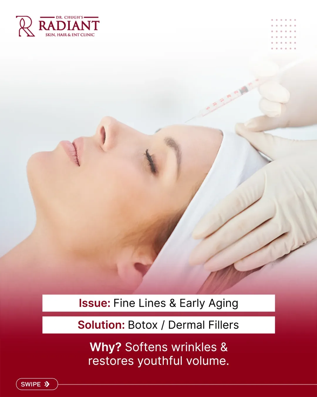 Cosmetic injection treatment for fine lines
