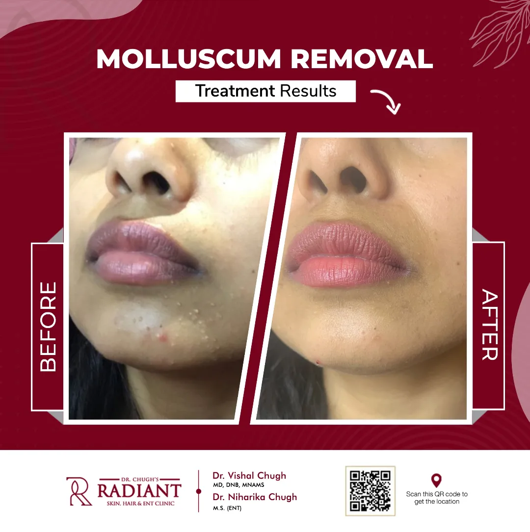 Treatment result 1