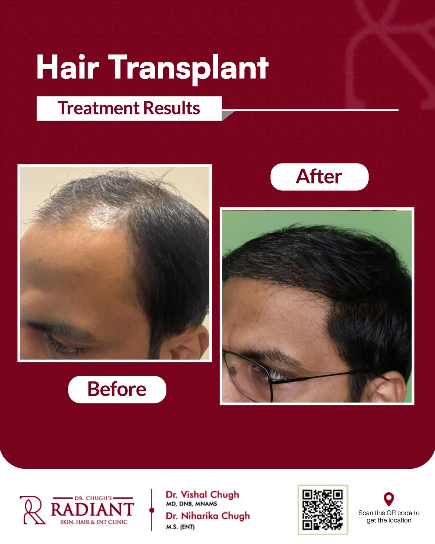 Treatment result 10