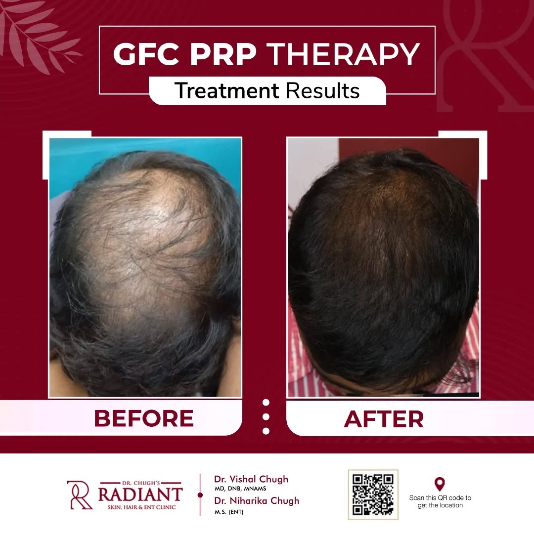 Treatment result 2
