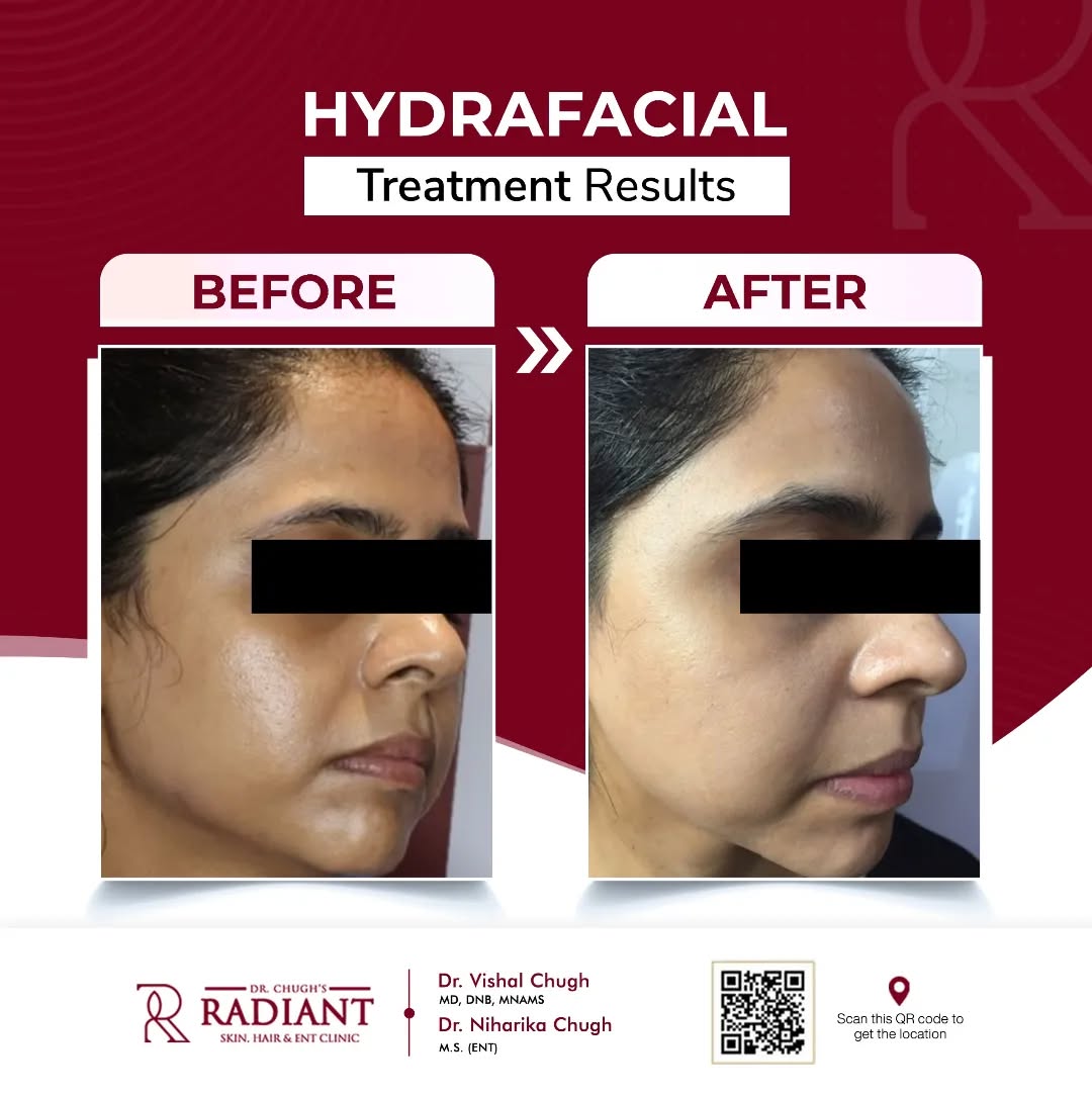 Treatment result 3