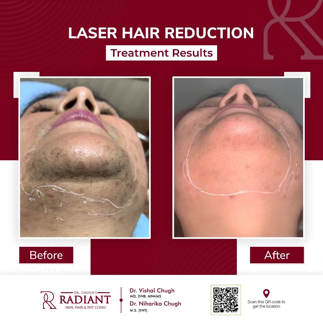 Treatment result 4