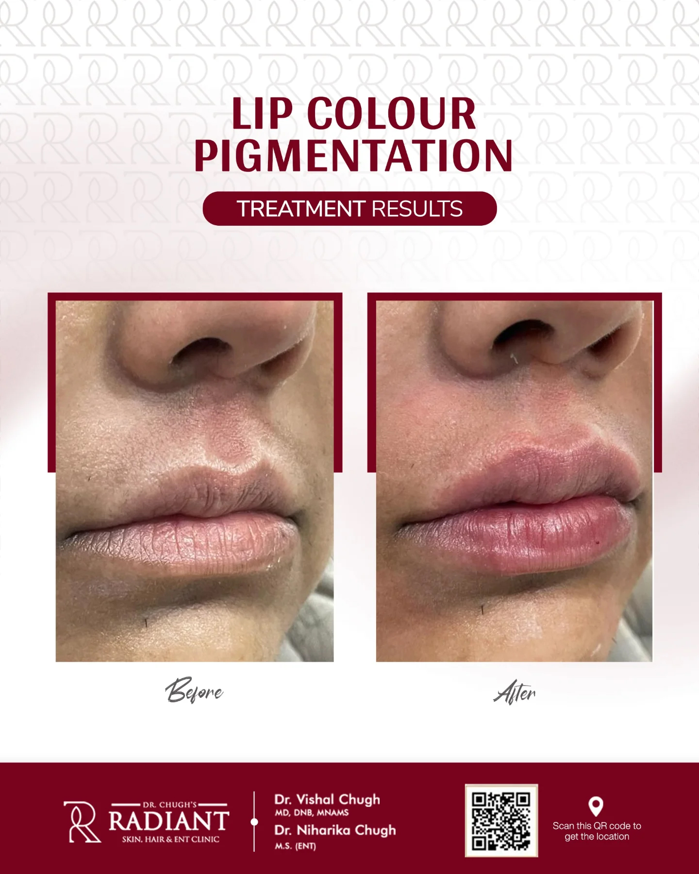 Treatment result 5