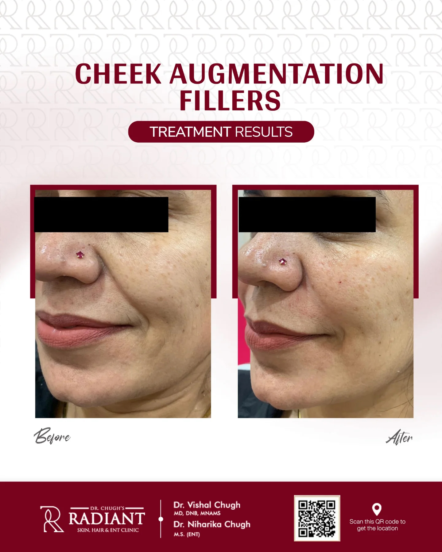 Treatment result 6