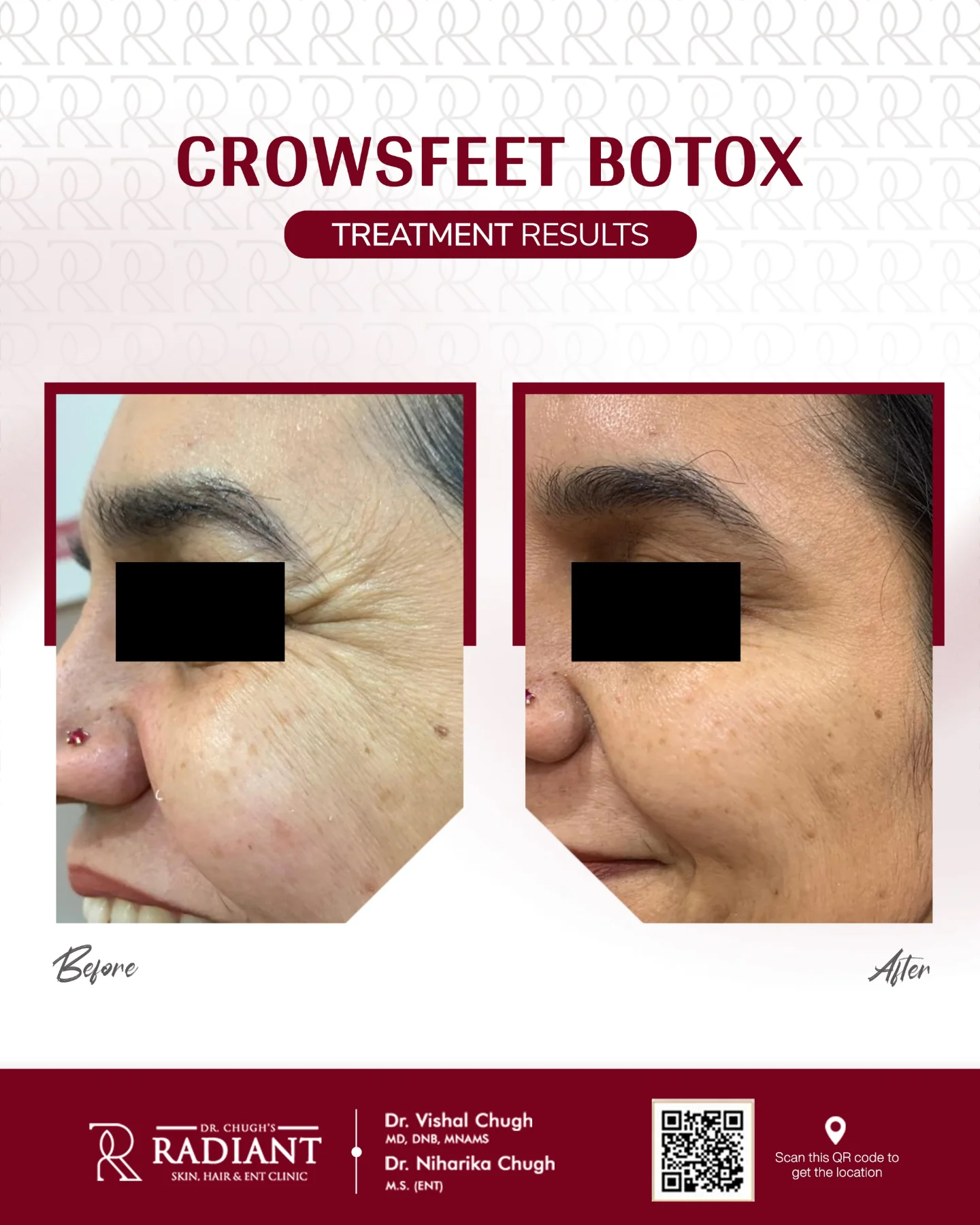 Treatment result 7