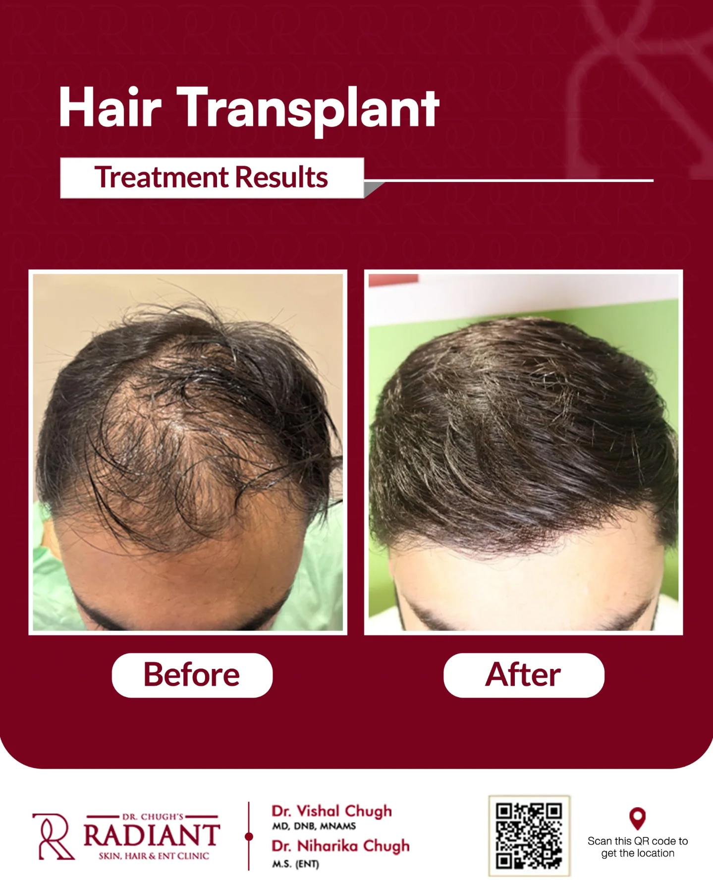 Treatment result 8