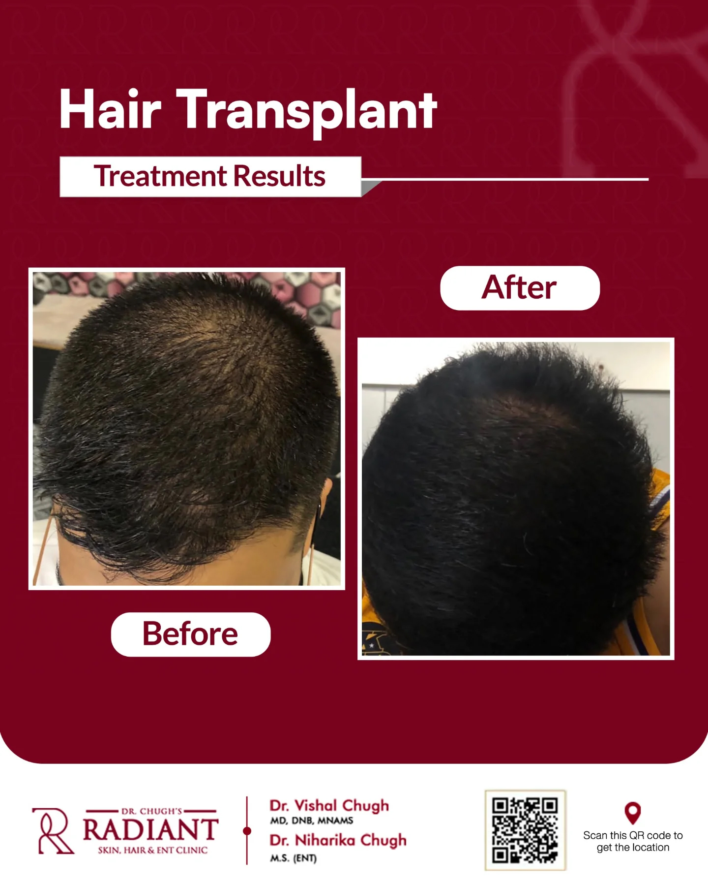 Treatment result 9