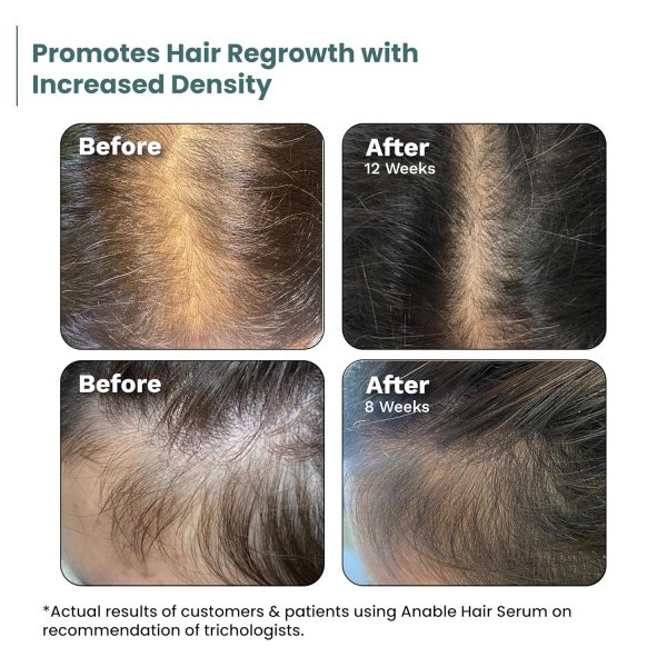 anable-hair-serum-6