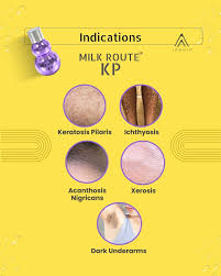 milk-route-kp-4